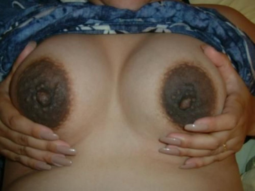 Большие темные ореолы сосков