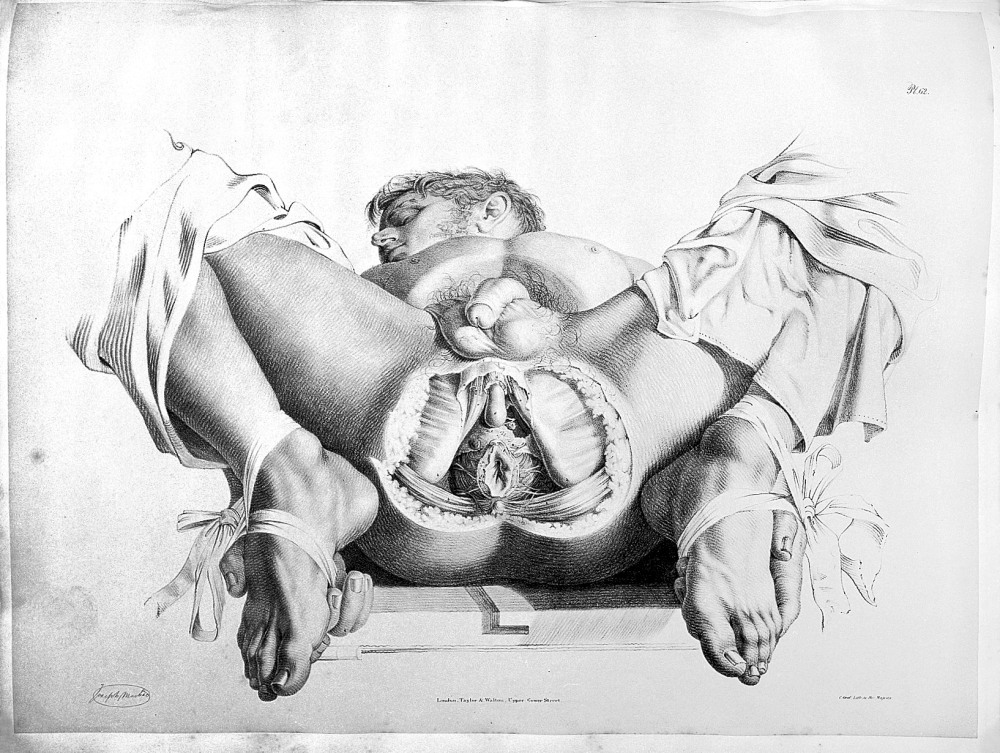 Влагалище и матка изнутри