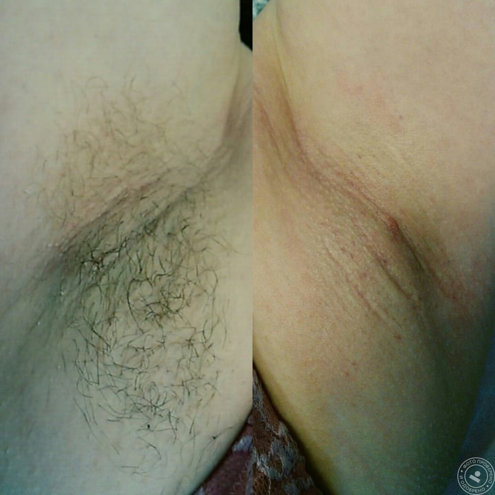 Голые купальники ниточки