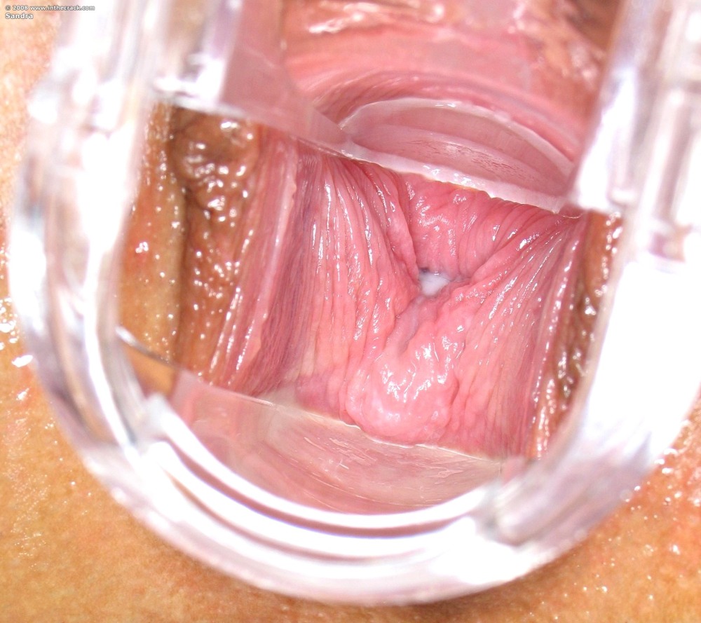 Фото вагины крупным планом