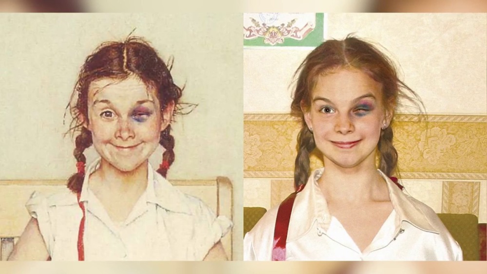 Крем от синяков и отеков под глазами