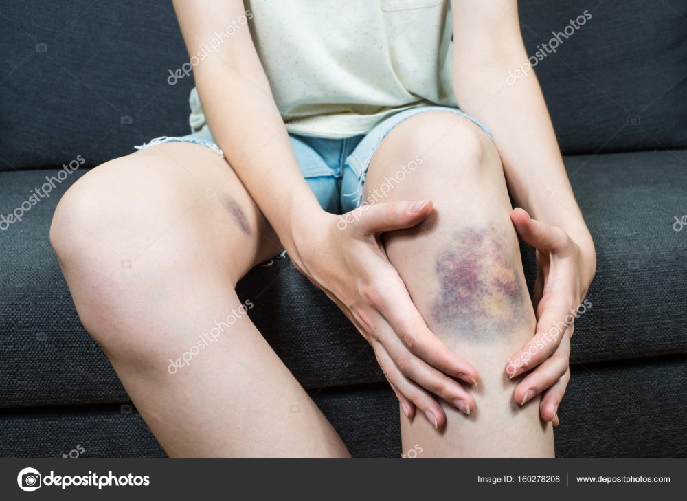 Валентина Шевченко и Холли Берри