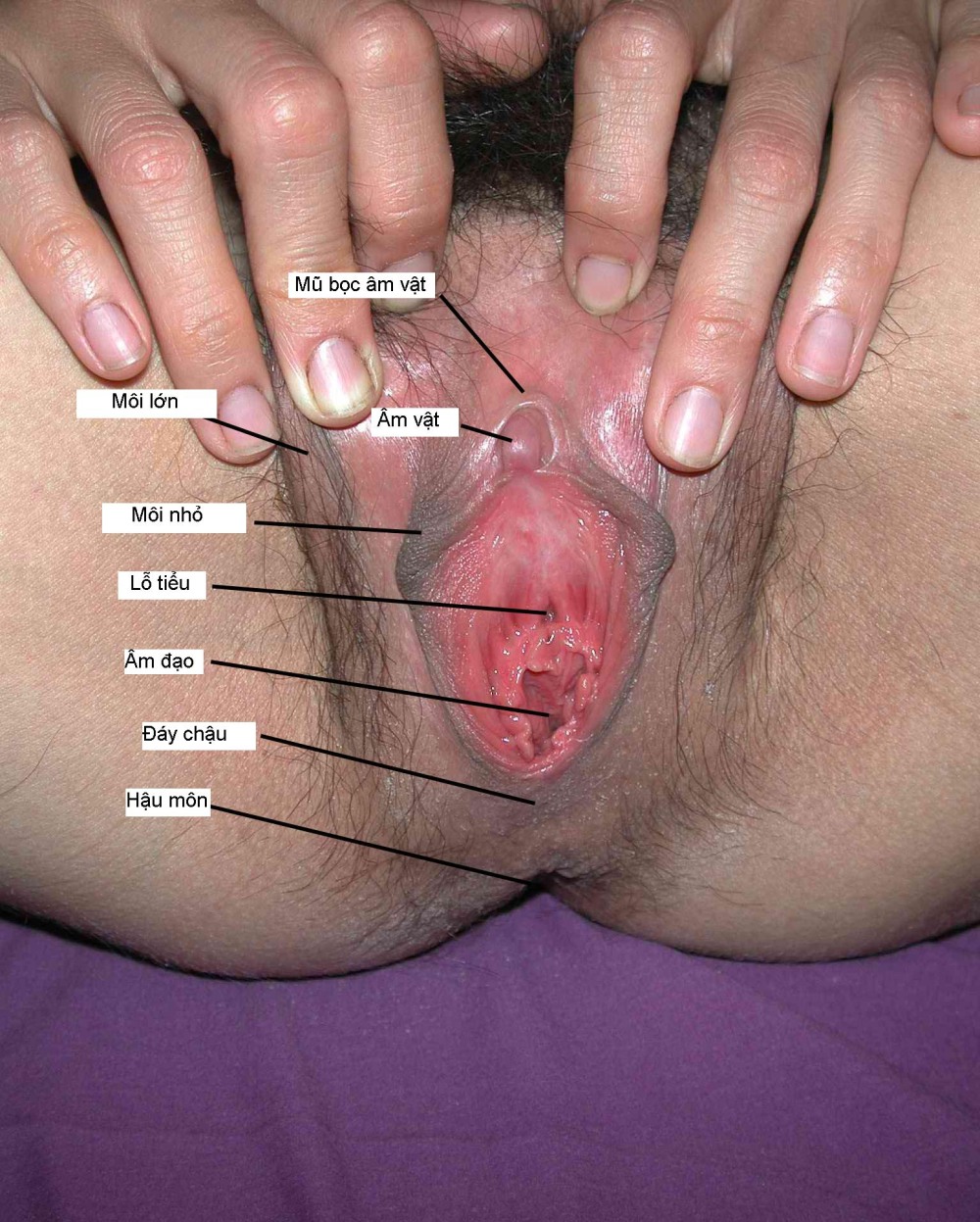 Клиторальный капюшон