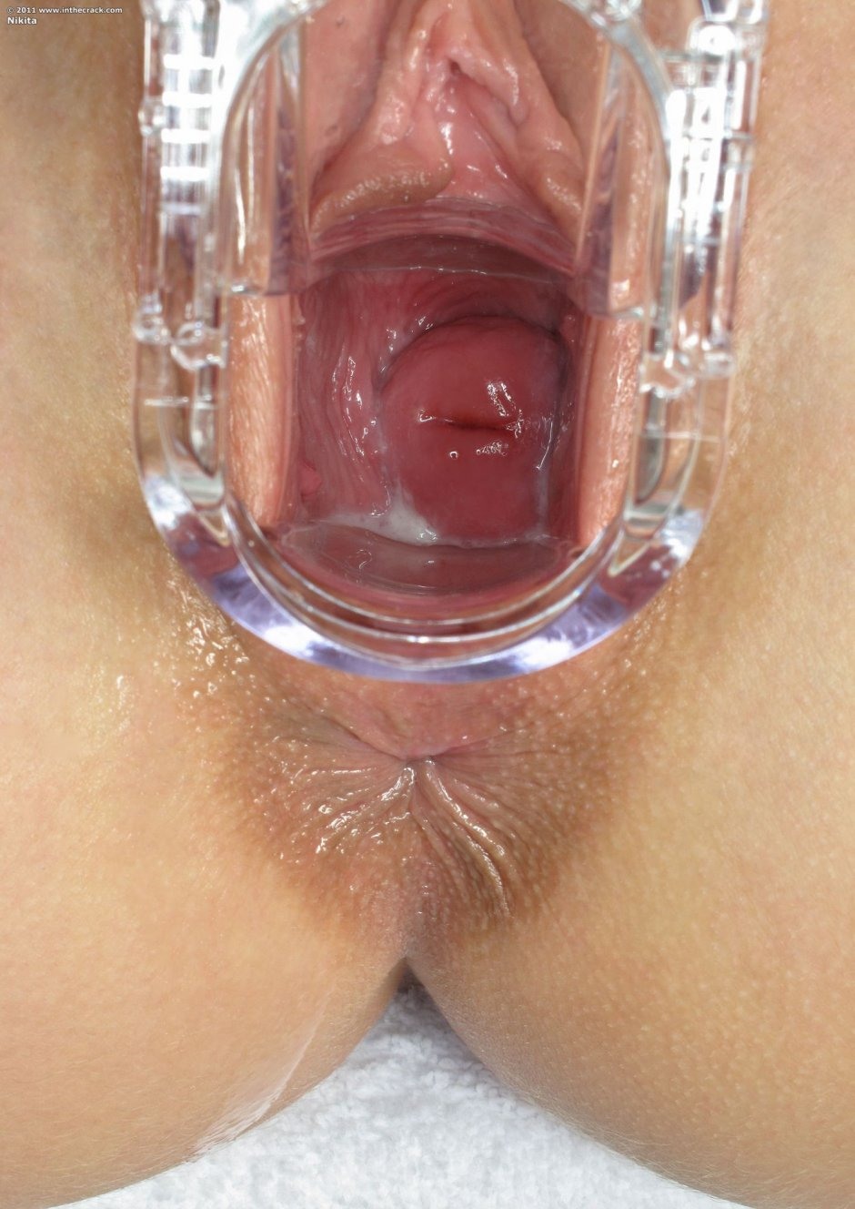 Девушки с расширителем влагалища