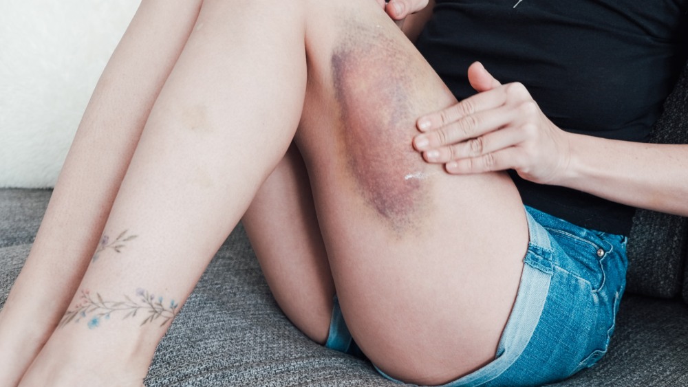 Статистика травматизма в России 2020