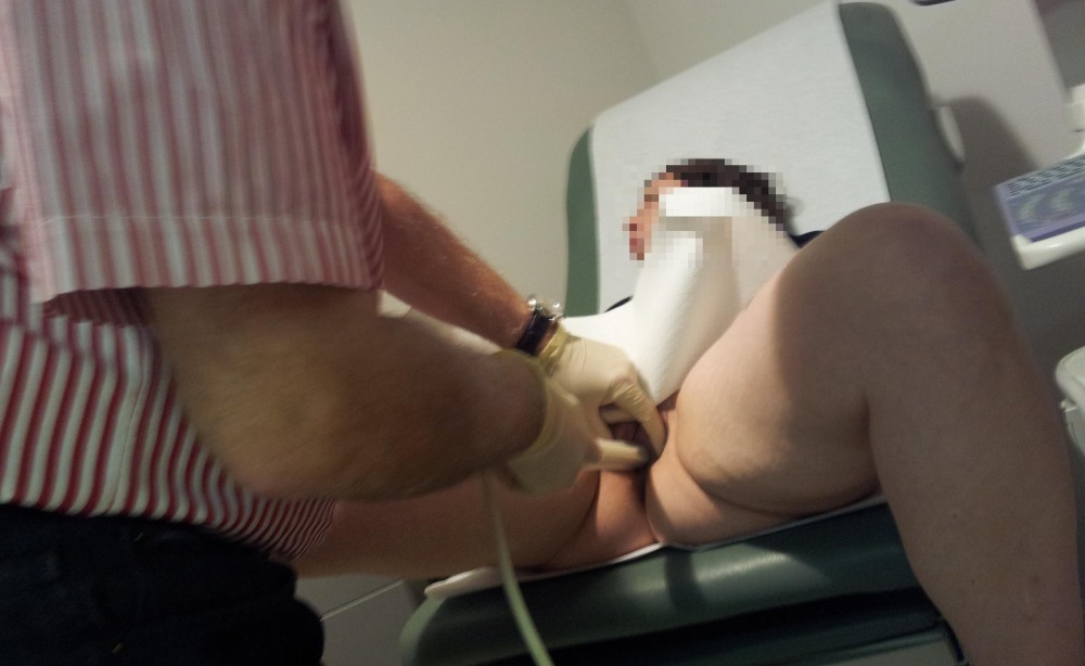 Скрытая камера в женской гинекологии