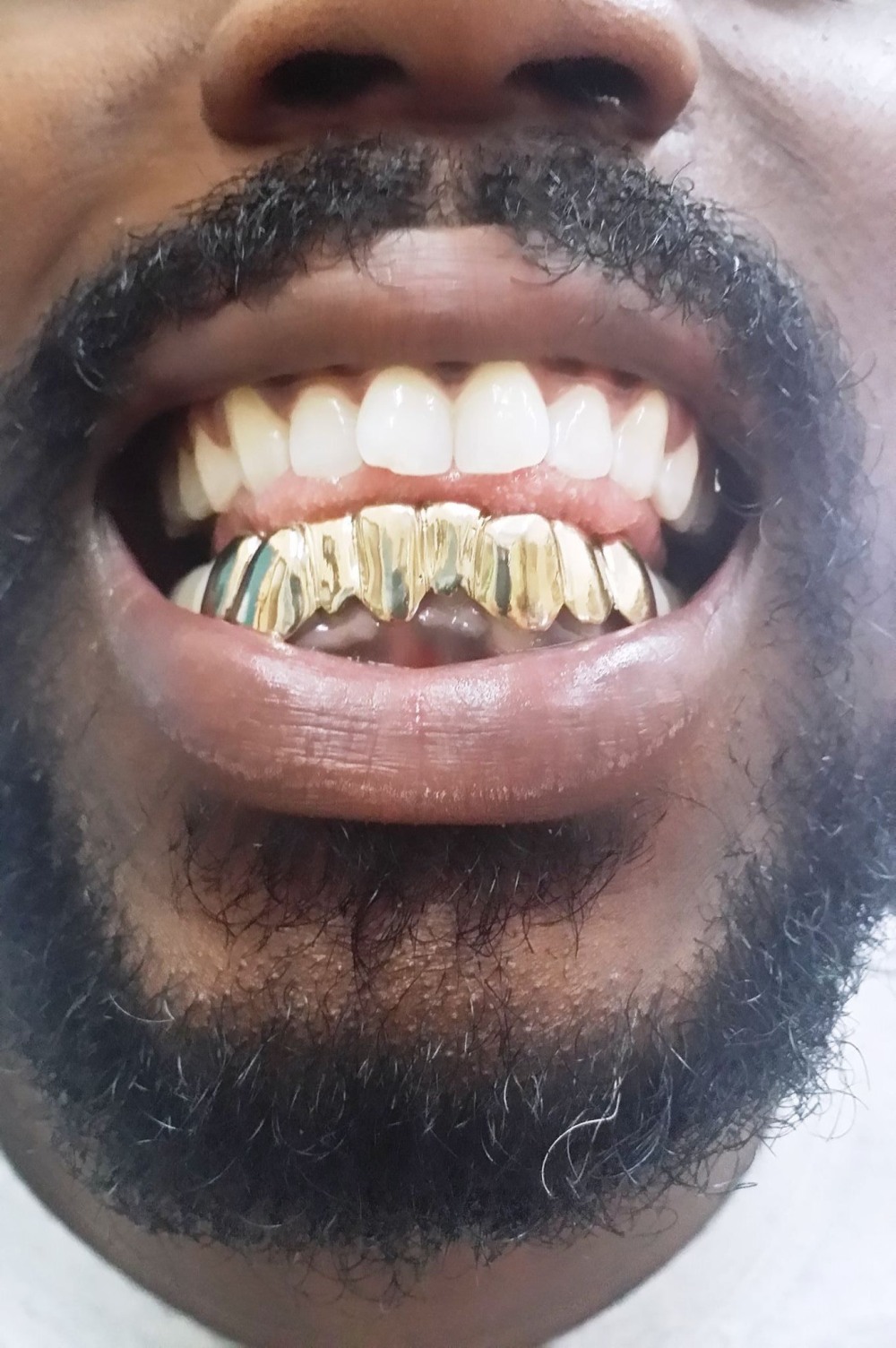 Grillz Gold Diamond