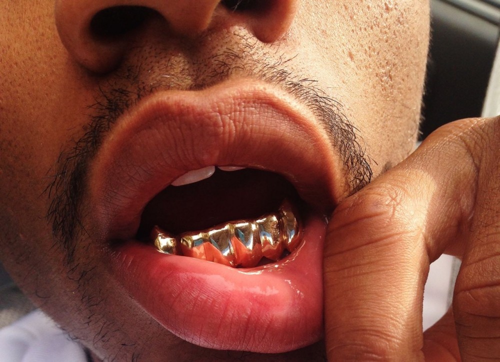 Красивые девушки с золотыми зубами