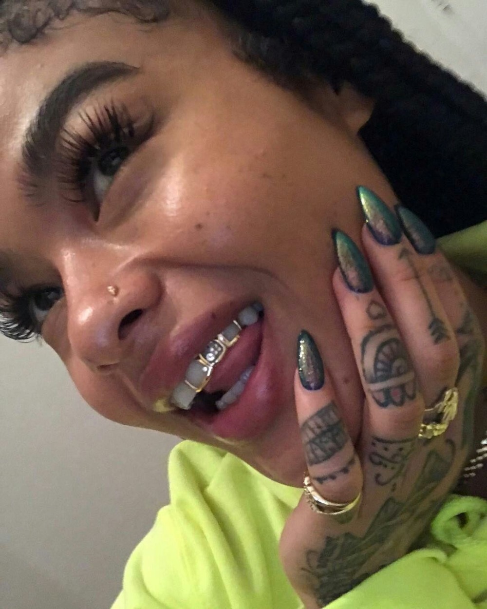 Блёстки на зубах Копейск цена установки