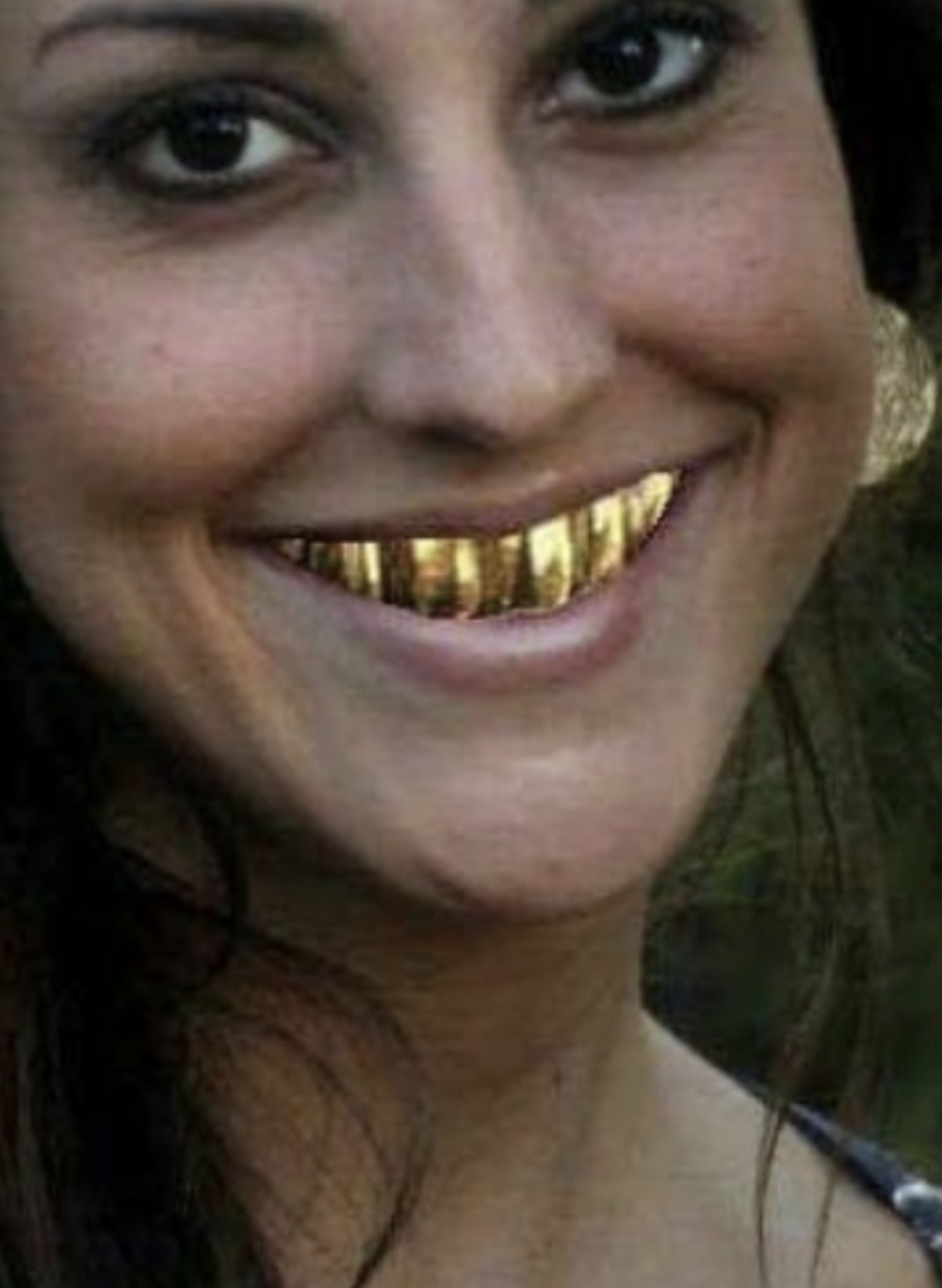 Натуральные зубы