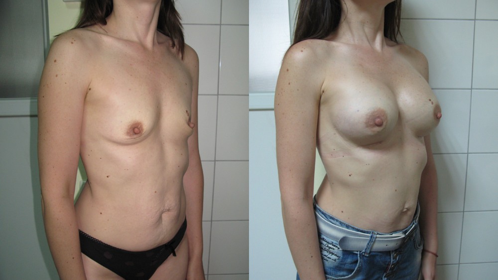 Маленькие сиськи первого размера частное