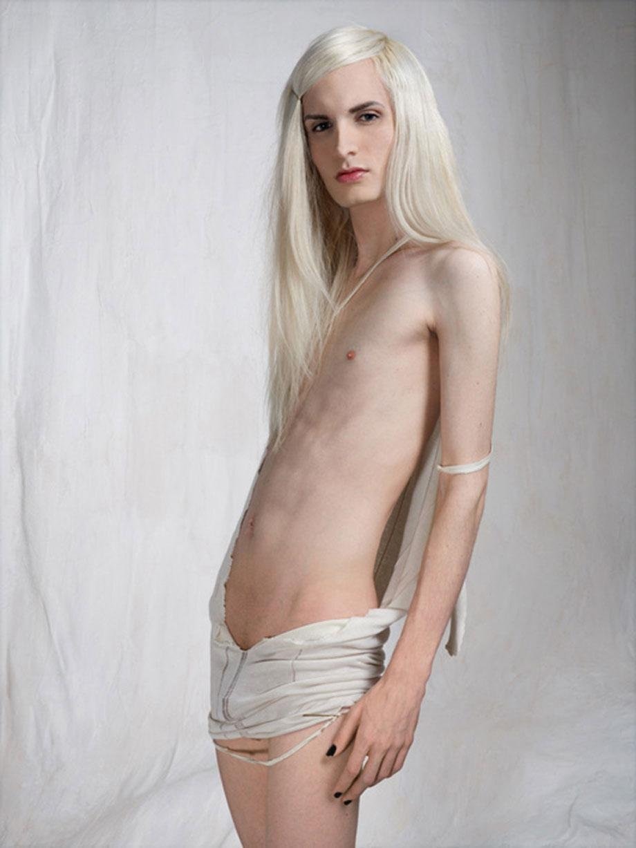 Albino Nude