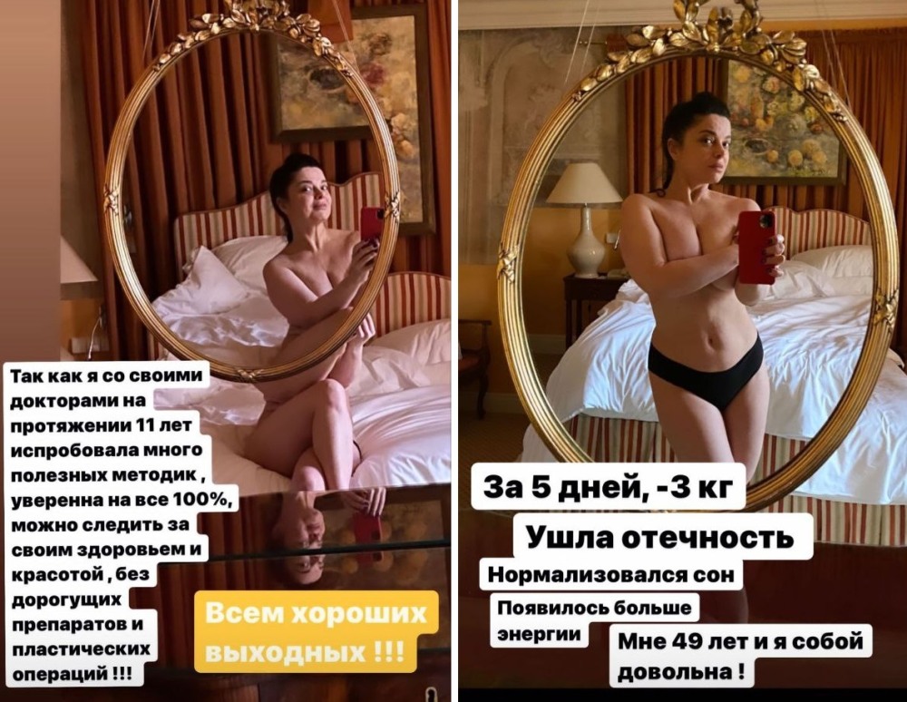 Наташа Королева снялась топлес