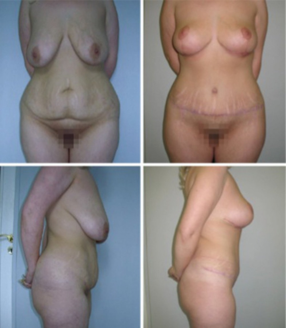 Голые сиськи после родов